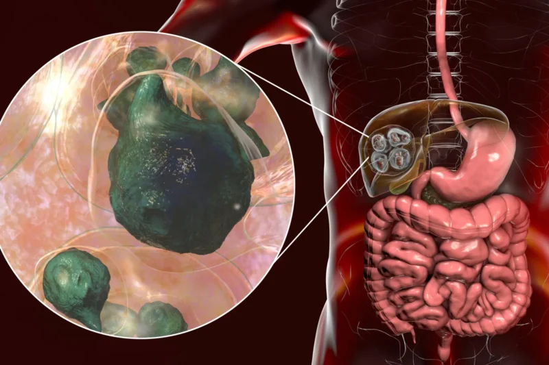 Dangerous Tapeworm Spreading Across North America Detected in the Pacific Northwest for the First Time